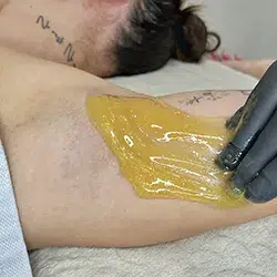 Kaenlaaluste sugaring ehk looduslik, nahasõbralik ja tõhus karvaeemaldus